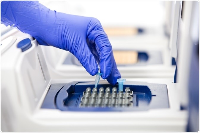 teste bacteriologice parodontita davinci dental clinic